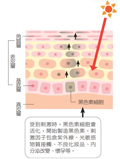 額頭黑斑|一次解析曬斑、肝斑、雀斑、顴骨母斑等皮膚黑斑原因…